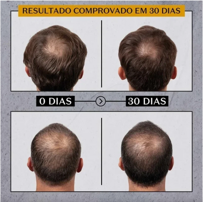 Kit for Anti Hair Loss Malbec  O BOTICÁRIO 600ml
